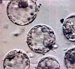 Stem cells