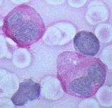 Stem cells