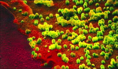 H1N1-Virus